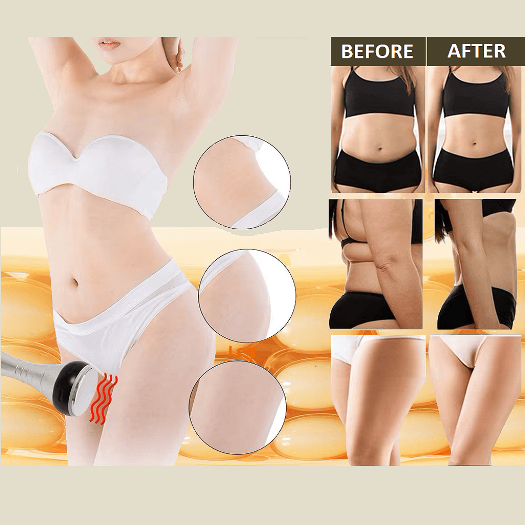 Vacuum massage for improved circulation and detoxification. Before. After