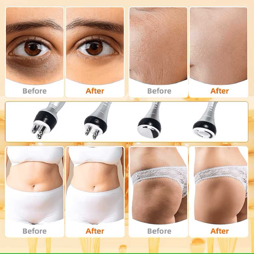 4-in-1 Body Contouring Machine attachments – Cavitation, RF, vacuum, and infrared for different body areas