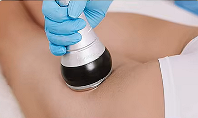 40kHz ultrasonic cavitation fat reduction treatment in progress - 10-15 minute session